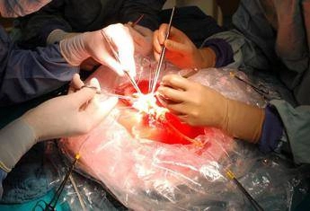 Trapianti, a Padova impiantato il fegato di una 99enne: la donatrice più anziana di sempre